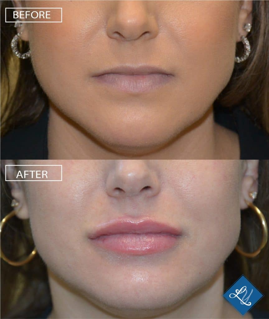 ashley lips