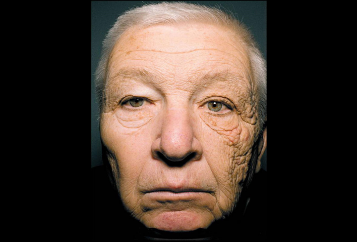 skin damaged driving