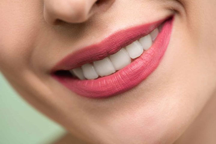 Lip Filler Aftercare