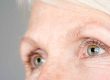 under-eye