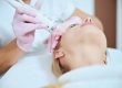 Laser Treatments