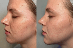 2025-11-17-BBLMOXI-01-2