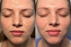 OLD LYWS Before & After - 2025-11-17-BBL+MOXI-01